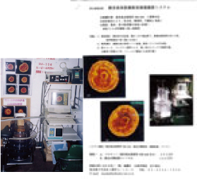 超音波体肢筋断面観察装置(産業技術研究所)